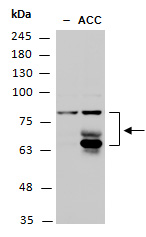ETR2 (C) Antibody, Rabbit Polyclonal