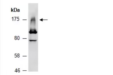 FLS2 (N) Antibody, Rabbit Polyclonal