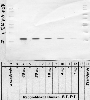 Anti-SLPI Rabbit Polyclonal Antibody