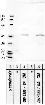 Anti-SerpinB12 Rabbit Polyclonal Antibody