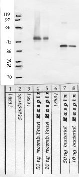 Anti-SerpinB5 Rabbit Polyclonal Antibody