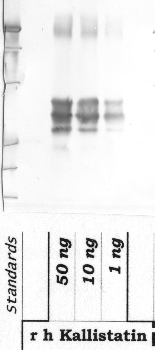 Anti-SERPINA4 Rabbit Polyclonal Antibody
