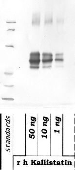 Anti-SERPINA4 Rabbit Polyclonal Antibody