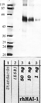 Anti-SPINT1 Rabbit Polyclonal Antibody