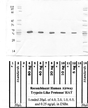 Anti-TMPRSS11D Rabbit Polyclonal Antibody
