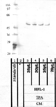 Anti-TMPRSS11A Rabbit Polyclonal Antibody