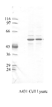 Anti-TMPRSS4 Rabbit Polyclonal Antibody
