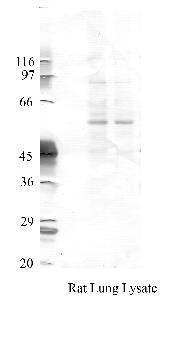 Anti-TMPRSS4 Rabbit Polyclonal Antibody