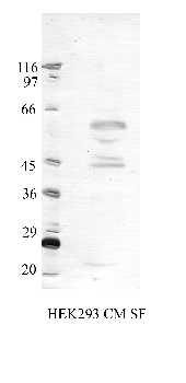 Anti-TMPRSS3 Rabbit Polyclonal Antibody