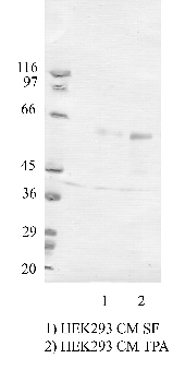 Anti-TMPRSS3 Rabbit Polyclonal Antibody