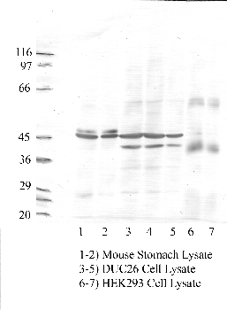 Anti-TMPRSS2 Rabbit Polyclonal Antibody