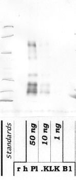 Anti-KLKB1 Rabbit Polyclonal Antibody