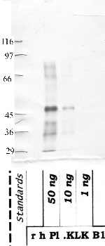 Anti-KLKB1 Rabbit Polyclonal Antibody