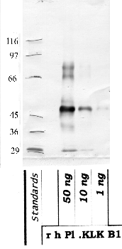 Anti-KLKB1 Rabbit Polyclonal Antibody