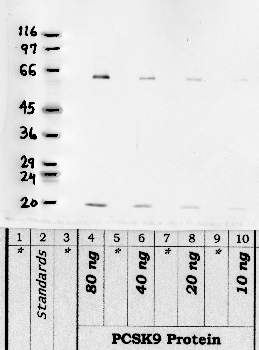 Anti-PCKS9 Rabbit Polyclonal Antibody