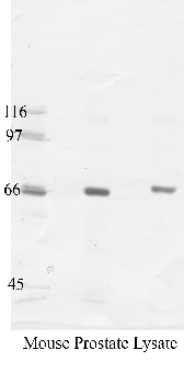 Anti-PCKS7 Rabbit Polyclonal Antibody