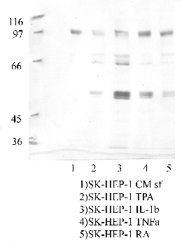 Anti-TMPRSS6 Rabbit Polyclonal Antibody