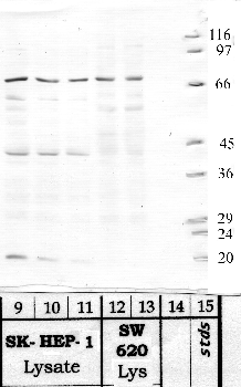 Anti-ST14 Rabbit Polyclonal Antibody