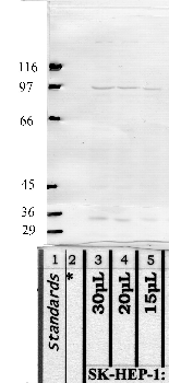 Anti-MASP2 Rabbit Polyclonal Antibody