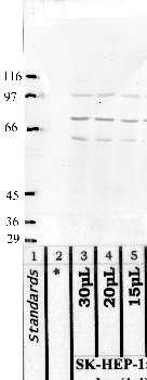 Anti-MASP2 Rabbit Polyclonal Antibody