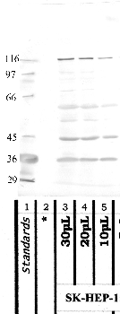Anti-MASP1 Rabbit Polyclonal Antibody