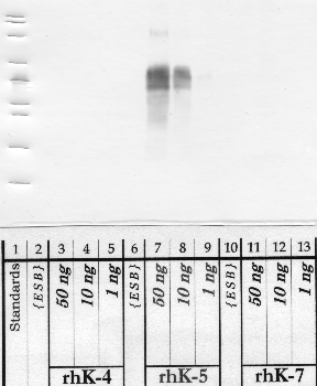 Anti-KLK5 Rabbit Polyclonal Antibody
