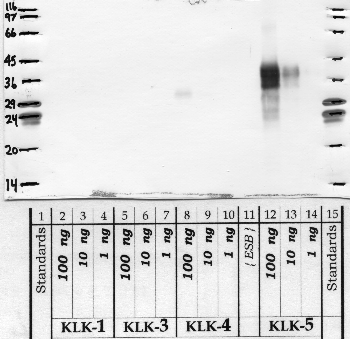 Anti-KLK5 Rabbit Polyclonal Antibody
