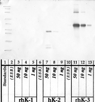 Anti-KLK3 Rabbit Polyclonal Antibody