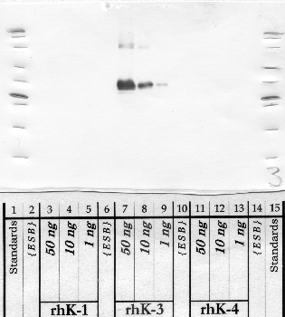 Anti-KLK3 Rabbit Polyclonal Antibody
