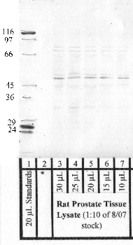 Anti-HTRA4 Rabbit Polyclonal Antibody