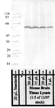 Anti-HTRA4 Rabbit Polyclonal Antibody