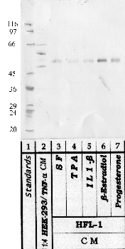Anti-HTRA1 Rabbit Polyclonal Antibody
