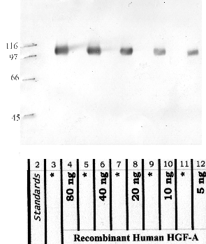 Anti-HGFAC Rabbit Polyclonal Antibody