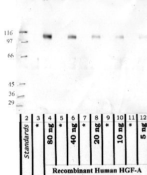 Anti-HGFAC Rabbit Polyclonal Antibody
