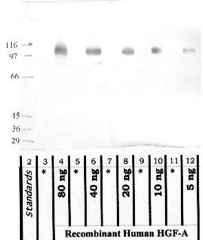 Anti-HGFAC Rabbit Polyclonal Antibody