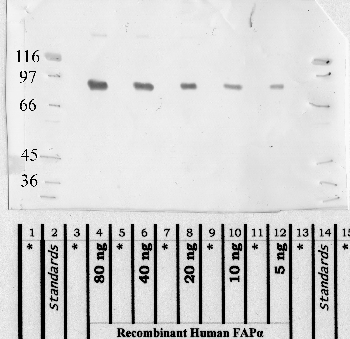 Anti-FAP Rabbit Polyclonal Antibody