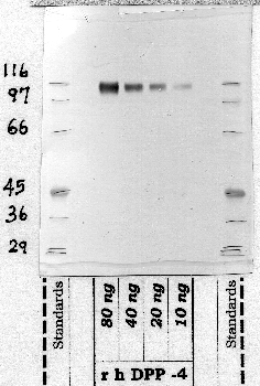 Anti-DPP4 Rabbit Polyclonal Antibody
