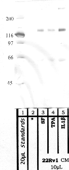 Anti-PAPPA Rabbit Polyclonal Antibody