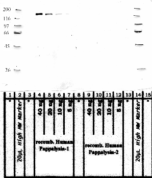 Anti-PAPPA Rabbit Polyclonal Antibody