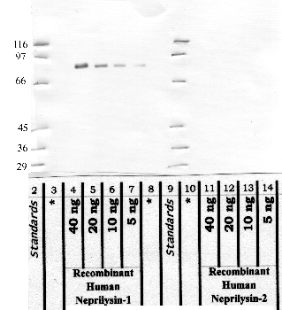 Anti-MME Rabbit Polyclonal Antibody