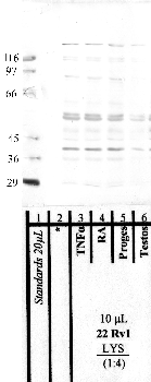 Anti-MME Rabbit Polyclonal Antibody