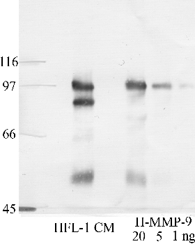 Anti-MMP9 Rabbit Polyclonal Antibody
