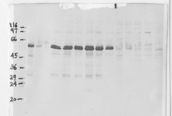 Anti-MMP3 Rabbit Polyclonal Antibody