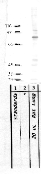 Anti-ADAMTS6 Rabbit Polyclonal Antibody