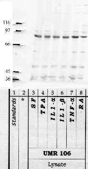 Anti-ADAMTS5 Rabbit Polyclonal Antibody