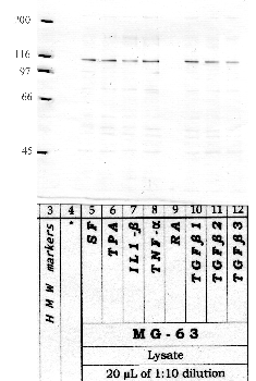 Anti-ADAMTS2 Rabbit Polyclonal Antibody