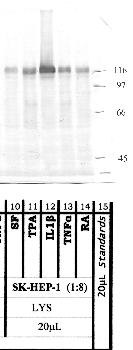 Anti-ADAMTS1 Rabbit Polyclonal Antibody