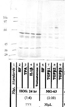 Anti-ADAM8 Rabbit Polyclonal Antibody