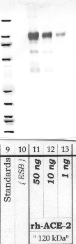 Anti-ACE2 Rabbit Polyclonal Antibody