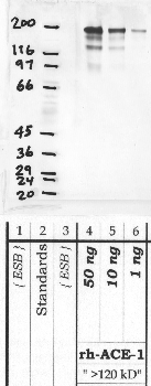 Anti-ACE Rabbit Polyclonal Antibody